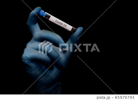 Hand in glove holding a test tube with the Hand in glove holding a test tube with the 65970793