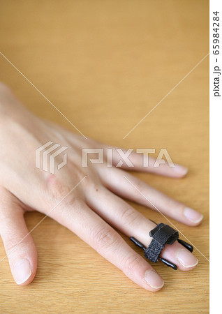 マレット変形の治療(バネ式固定装具) マレット変形の治療(バネ式固定装具) 65984284