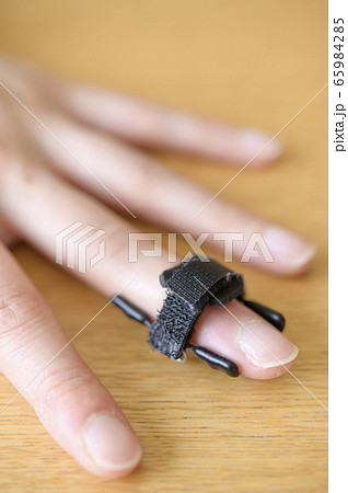 マレット変形の治療（バネ式固定装具） 65984285