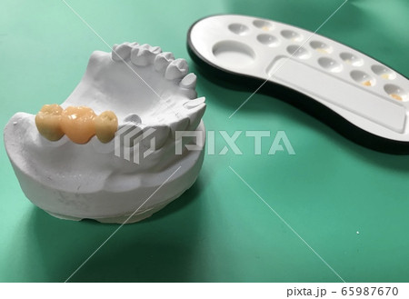 ブリッジ 65987670