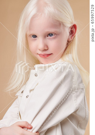 portrait of smiling albino child isolated 65997529