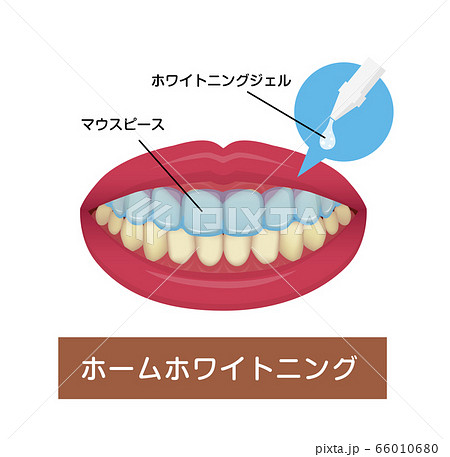 歯のホワイトニング ホームホワイトニング ベクターイラスト のイラスト素材