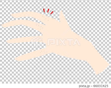 Useless hair on fingers Useless hair on fingers 66031425