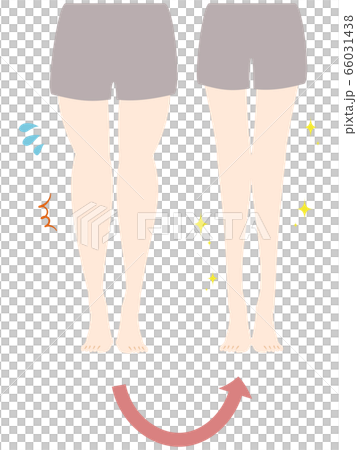 Swollen legs, refreshing legs 66031438