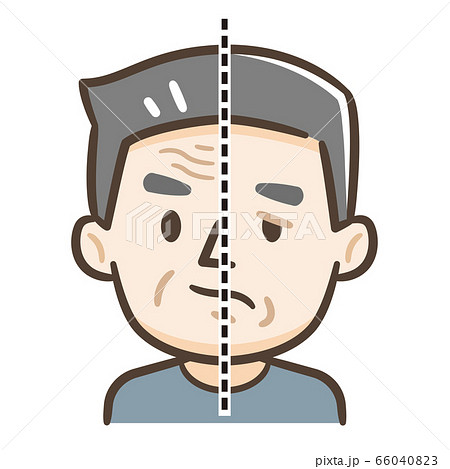 顔面神経麻痺のイラスト素材