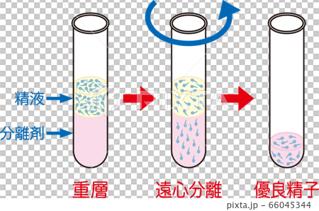 人工授精 密度勾配遠心法のイラスト素材