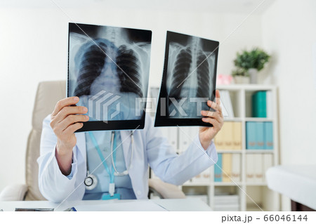 Doctor comparing lungs x-rays 66046144