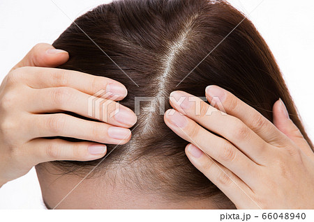 頭皮ケア 66048940