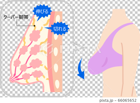 Woman Breast Cutaway Diagram. Stock Illustration - Illustration of