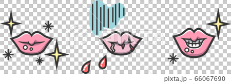 唇のひび割れ・剥け 線グレー 唇のひび割れ・剥け 線グレー 66067690