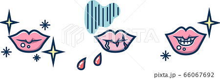 唇のひび割れ・剥け 線ブルー 唇のひび割れ・剥け 線ブルー 66067692