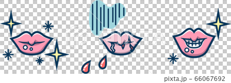 唇のひび割れ・剥け 線ブルー 唇のひび割れ・剥け 線ブルー 66067692