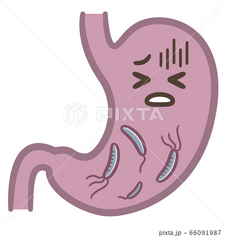 ピロリ菌に苦しむ胃のイラストレーションのイラスト素材
