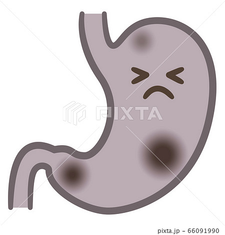 胃癌に苦しむ胃のイラストレーションのイラスト素材