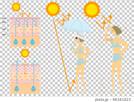 一個女人在泳裝上曬傷皮膚結構的插圖 66161823