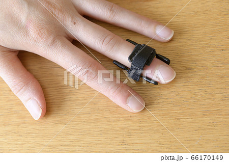 マレット変形の治療（バネ式固定装具） 66170149