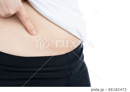 Closeup of woman showing scar on her belly from 66182472