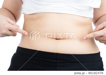 Fat woman holding excessive fat belly, overweight 66182476
