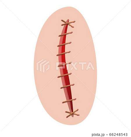 Suture icon, cartoon style 66248543