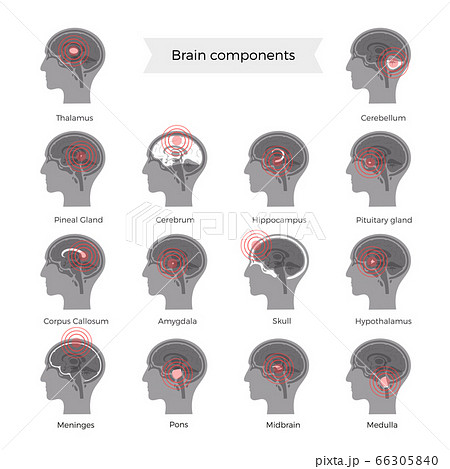 Pain Brain Illustration 66305840