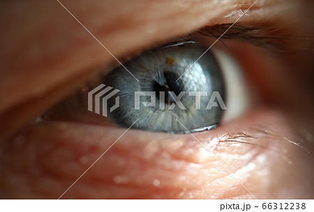 Male gray blue colored right eye in low light technique 66312238