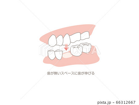 歯 66312667