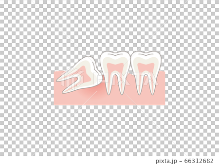 Tooth Tooth 66312682