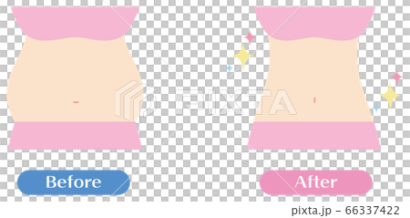 Before after a diet 66337422