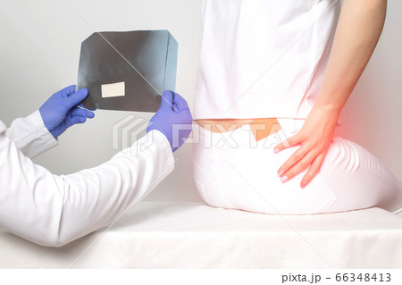 Doctor traumatologist holds an x-ray picture of the patient's hip neck. Woman hip fracture concept, endoprosthetics, hip arthroplasty Doctor traumatologist holds an x-ray picture of the patient's hip neck. Woman hip fracture concept, endoprosthetics, hip arthroplasty 66348413