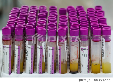 Blood tube for testing in laboratory Blood tube for testing in laboratory 66354277