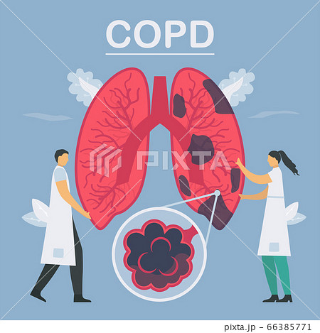 Chronic Obstructive Pulmonary Disease Or Copd のイラスト素材