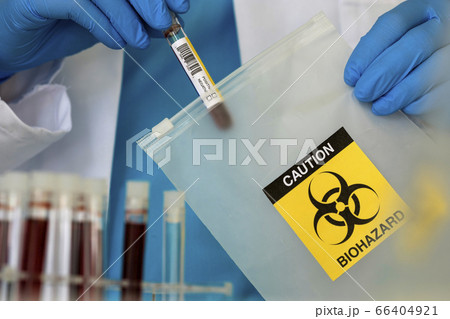 Lab professional putting vial into string bag with biohazard sign 66404921