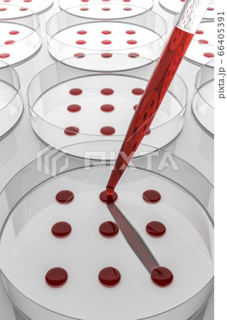 Blood sample tested on petri dish in laboratory Blood sample tested on petri dish in laboratory 66405391