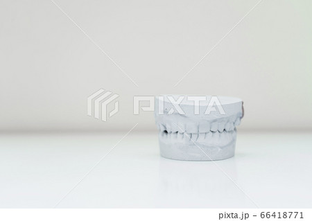 plaster cast of the jaw on a table in a bright 66418771