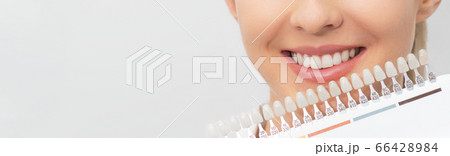 Teeth whitening process. Dental care 66428984