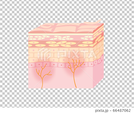 皮膚炎或皮膚粗糙的皮膚 皮膚炎或皮膚粗糙的皮膚 66487062