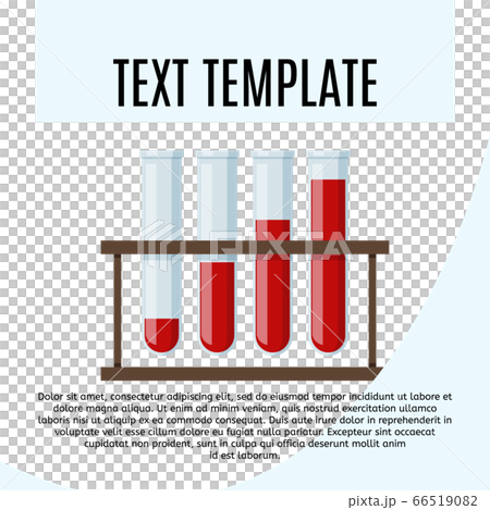 Test tube stand. Set of glass containers with blood. Medical vector illustration. 66519082