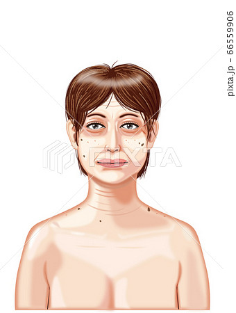 熟年女性 美容外科のイラスト素材