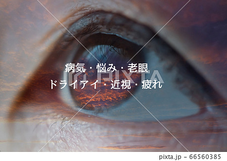 目のトラブル 66560385