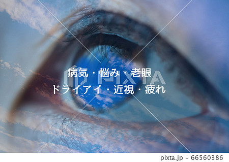 目のトラブル 66560386