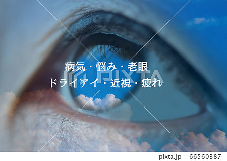 目のトラブル 66560387