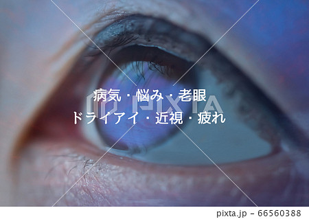 目のトラブル 目のトラブル 66560388