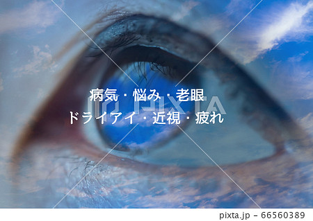 目のトラブル 66560389