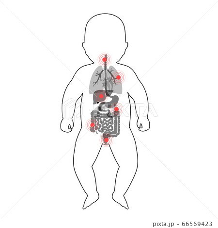 Pain in human body Pain in human body 66569423