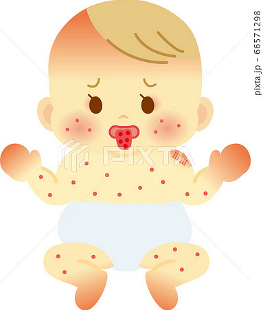 川崎病のおしめ姿の赤ちゃん ベビー全身イラスト21のイラスト素材