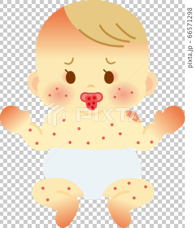 川崎病のおしめ姿の赤ちゃん ベビー全身イラスト21のイラスト素材