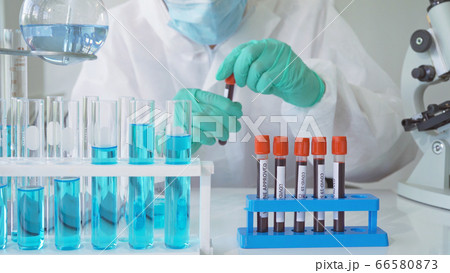 Asian Scientist working on blood test tube to Asian Scientist working on blood test tube to 66580873