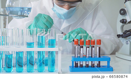 Asian Scientist working on blood test tube to Asian Scientist working on blood test tube to 66580874