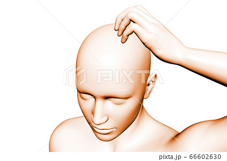 頭のかゆみ 66602630