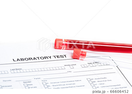 Form to fill in with results of blood test in tube 66606452